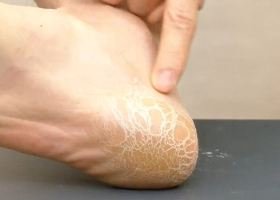 A show host shows foot flakes that were actually rice paste shavings to advertise exfoliation products during a shopping broadcast. [SCREEN CAPTURE]