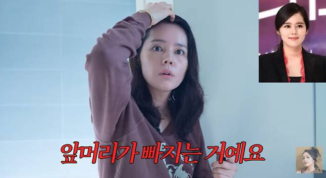 유전적으로 머리숱이 많았다는 한가인은 둘째 출산 후 탈모가 왔다고 고백했다. [사진=유튜브 채널 '자유부인 한가인']