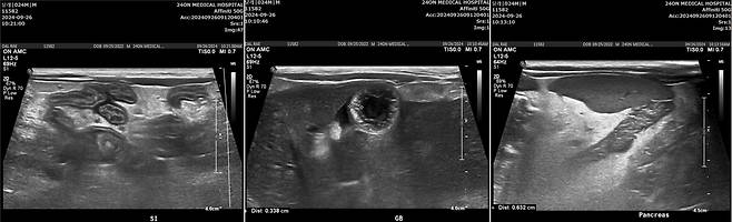 부산 24시온동물의료센터 고양이 담관간염 치료 사례, 치료 전 복부 초음파 사진 (동물병원 제공) ⓒ 뉴스1