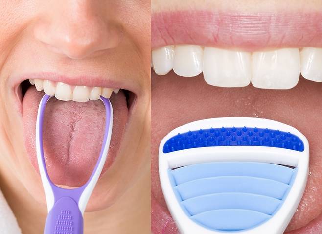 혀 클리너를 쓸 때 중요한 건 혀에 심한 자극을 주지 않는 것이다. 위생을 생각한다면 스테인리스형을 권한다./사진=게티이미지뱅크