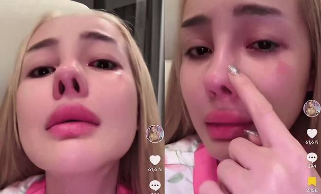 응안98이 눈물을 흘리며 성형 부작용을 주장하고 있다. /독 나잉