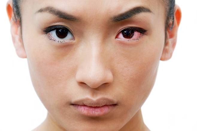 눈 충혈 증상은 눈 건강 외에 몸에 이상이 있음을 알리는 초기 신호일 수 있다. [사진=클립아트코리아]