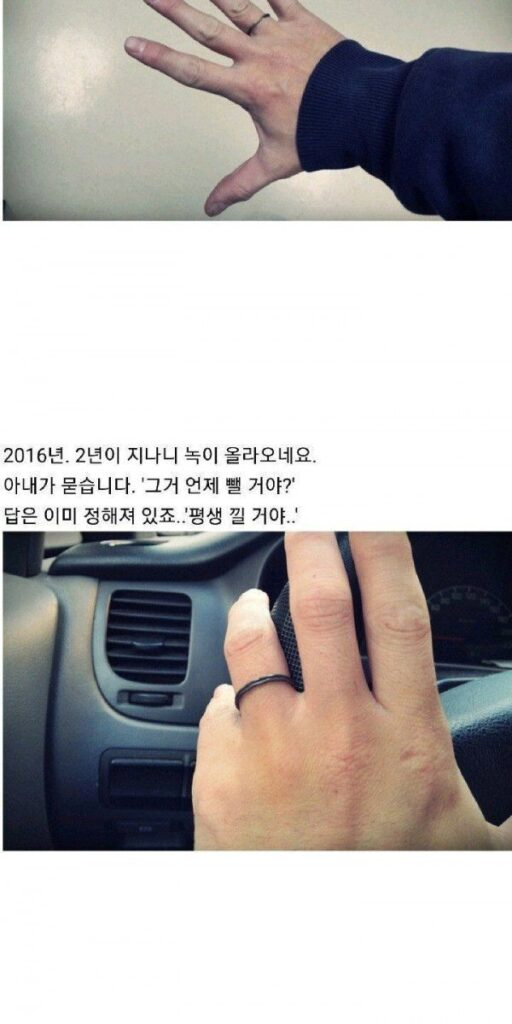 image.png 9년 동안 손가락에서 빼지 못한 반지..