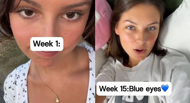 사진설명=세 달이상 사용하면 눈동자 색이 바뀐다는 안약이 화제다./사진=틱톡 채널 ‘팬시드롭스뷰티