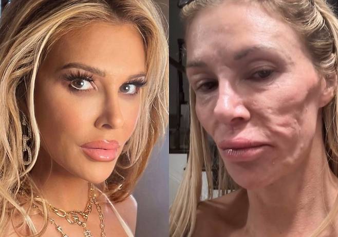 브랜디 글랜빌 소셜미디어