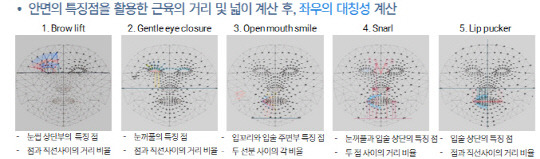 안면마비 자동진단 시스템에서 비대칭 점수 계산 및 특징 추출 방법. KIST 제공.