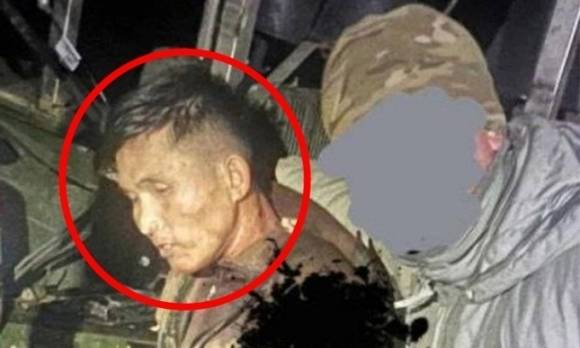 2024년 말 우크라이나 특수부대가 공개한 북한군 추정 포로 사진. 국가정보원은 해당 병사가 부상 악화로 생포 하루 만에 숨졌다고 밝혔다. 텔레그램 캡처