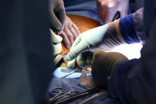 미국 하버드대 의대 의료진이 유전자 편집 돼지 신장을 사람에게 이식하는 수술을 하고 있다. 하버드대 의학전문대학원 매사추세츠종합병원 제공