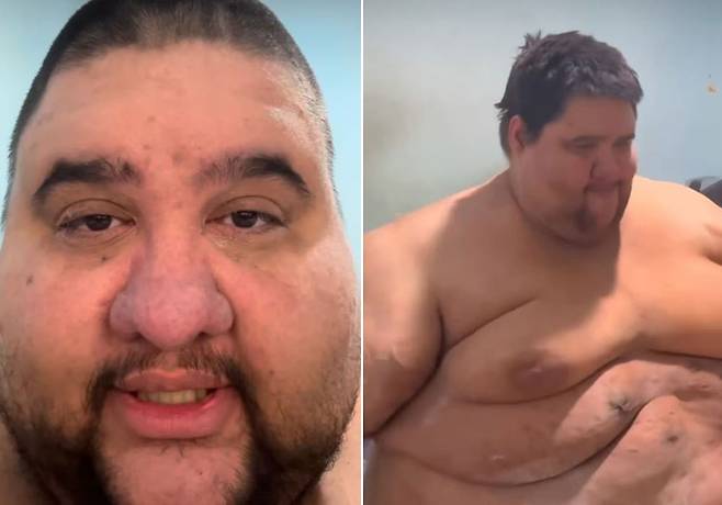 약 200kg을 감량해 화제가 됐지만 다시 381kg까지 몸무게가 증가한 브라질의 인플루언서 가브리엘이 심장마비로 사망했다./사진=가브리엘 인스타그램 캡처