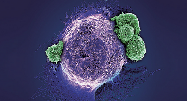 HLB는 간암 신약 리보세라닙이 지난 14일 FDA CMC 실사를 완료했다고 밝혔다. ⓒHLB 홈페이지