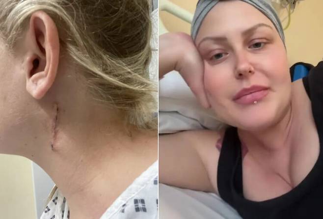 허리 통증을 E컵 가슴 탓이라 여겼던 30대 영국 여성이 4기 호지킨 림프종 진단을 받았다. 진단 전 여성은 이부프로펜 등 해열진통제를 복용했지만 가려움, 오한, 발열 등을 경험하며 오히려 증상이 악화했다. 결국 병원에 26일간 입원해야만 했던 여성은 목 부위의 절제 생검을 통해 병에 걸린 사실을 확인했다. [사진=영국 매체 더 선 보도 갈무리]