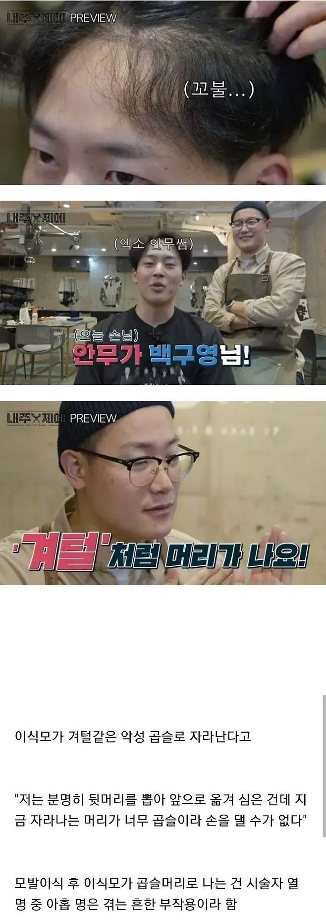 IMG_7215.jpeg 모발이식수술 부작용.jpg