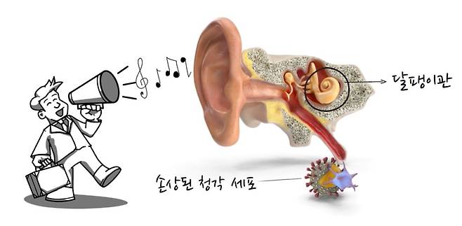 이명 발생 원리를 설명한 그림./뉴라이브