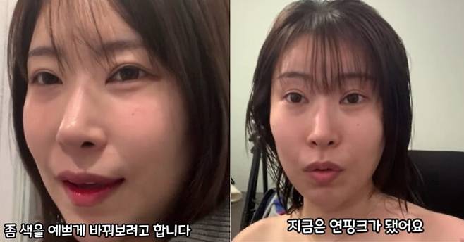 개그우먼 이세영이 자신의 가슴이 캐릭터 '펭수'같다며 유륜을 옅은 색으로 바꾸는 유륜 문신 시술을 받았다. [사진=유튜브 채널 '영평티비']