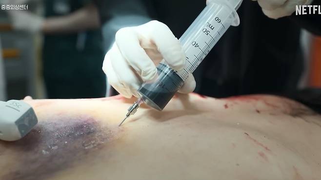 심장 천자(인체에 침을 찔러서, 체내로부터 액체, 세포나 조직을 채취) 하는 모습./사진=유튜브 채널 'Netflix Korea 넷플릭스 코리아'