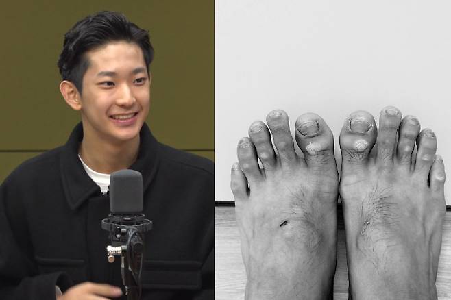 발레리노 박윤재의 발 (사진 제공 = 박윤재군 아버지)