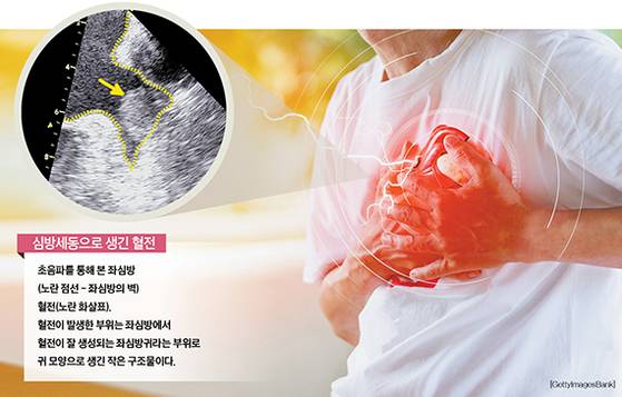 그래픽=정수경 기자 jung.suekyoung@joins.com