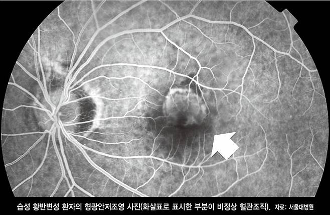 서울대병원 제공