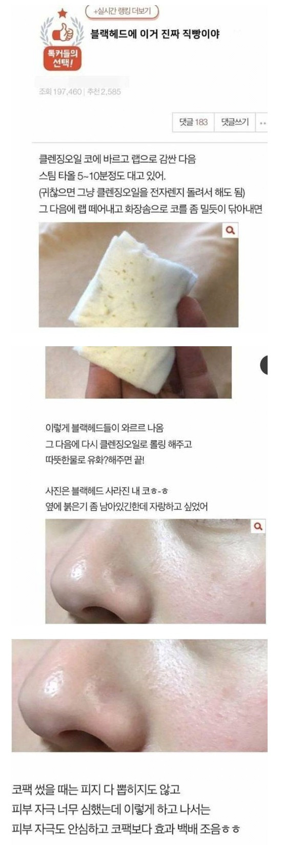 image.png 블랙헤드 없애는 방법이라고 함 .jpg