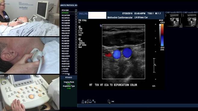 경동맥 초음파를 받는 장면.