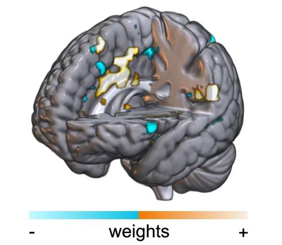 뇌 반응은 통증의 위치와 강도를 처리하는 데 관여하는 전반적인 뇌 활동을 보여준다. 이 반응은 도시나 실내 장면에 비해 가상의 자연 장면에 노출되었을 때 더 낮게 나타났다. 네이처 커뮤니케이션즈