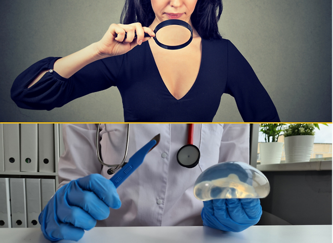 가슴 확대술 후에 나타날 수 있는 부작용을 일컫는 가슴 보형물 질환(Breast Implant Illness, BII). 의료계에서는 BII를 의학적 질병으로 인정하지 않고 있는 가운데, 세계적으로 BII 증상을 경험하는 사람들의 수는 꾸준히 증가하고 있다.[사진=게티이미지뱅크]
