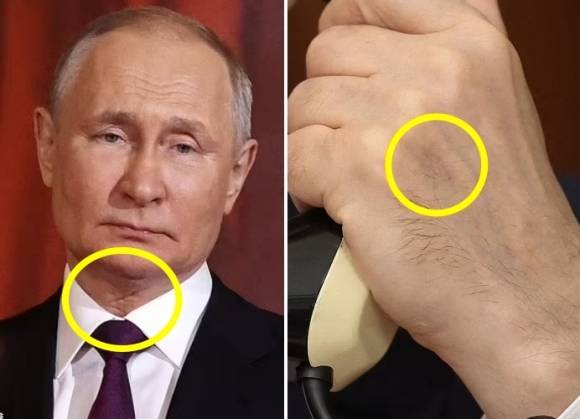 2023년 4월 16일, 정교회 부활절 예배에 참석한 푸틴 러시아 대통령의 목에서 상처로 추정되는 흔적이 포착됐다(왼쪽), 전화 통화를 하는 푸틴 대통령의 손등에 주사 자국으로 추정되는 흔적을 담은 사진(오른쪽). AFP 연합뉴스