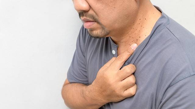 편평사마귀는 점처럼 보일 수 있지만, 순식간에 주변 부위로 퍼지는 특징이 있다｜출처: 게티이미지뱅크