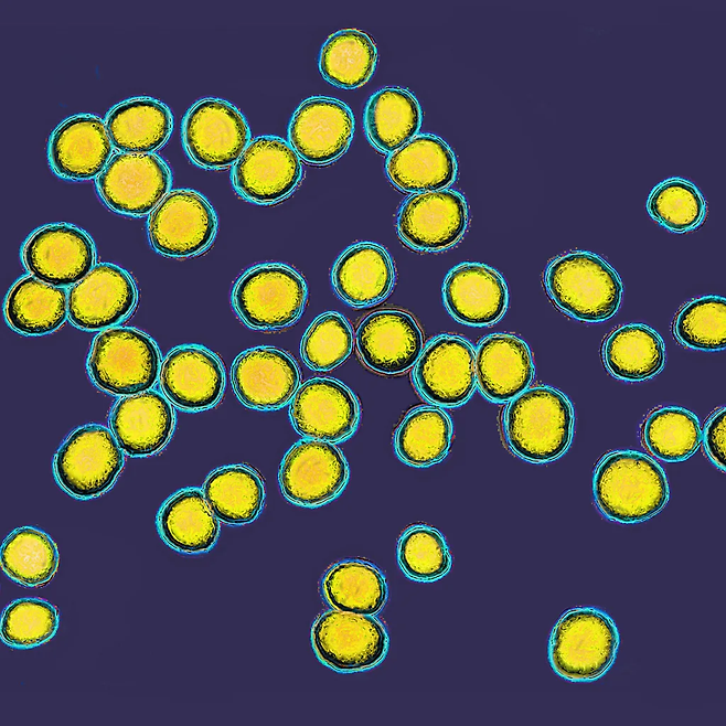 황색포도상구균은 흔한 박테리아인데, 몇 가지 피부 질환에 관여하는 것으로 알려져 있다