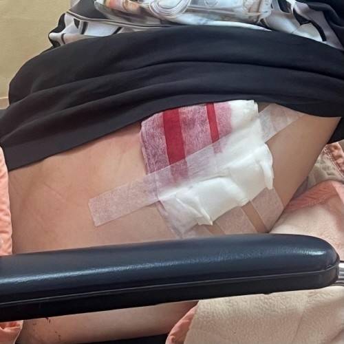 대만 피해자 한국인 부상사진.〈사진=연합뉴스〉