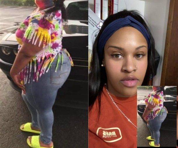 엉덩이 확대 수술 후 부작용 탓에 고약한 냄새로 고통받던 30대 여성 사연이 공개됐다. 사진=케이 몬태나 틱톡