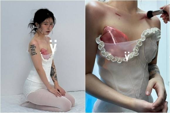 ‘폴란드 증후군’으로 인해 보석으로 만든 보형물을 착용한 쉬안씨. 보석 디자이너 이브민 SNS 캡처
