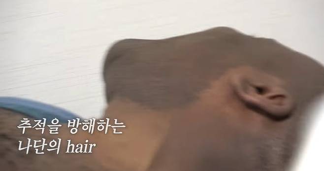 6.jpeg 조나단이 레이저 제모 못하는 이유.jpg