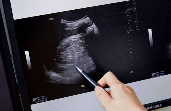 정경환 교수가 신장 초음파를 보며 설명하고 있다. 신장의 크기가 줄고 하얗게 보이는 염증(에코)이 증가한 게 신장이 망가져있다는 표시다./사진=신지호 기자