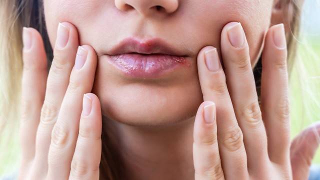 헤르페스 1형 바이러스는 일상적인 접촉으로도 전염될 수 있다|출처: 게티이미지뱅크
