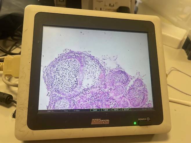 실험실 환경에서 배양한 치아를 현미경으로 확대한 모습. 영국 킹스 칼리지 런던 연구팀 제공