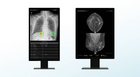 루닛 흉부 엑스레이 AI 영상분석 솔루션 '루닛 인사이트 CXR'(왼쪽)과 유방촬영술 AI 영상분석 솔루션 '루닛 인사이트 MMG'. 루닛 제공.