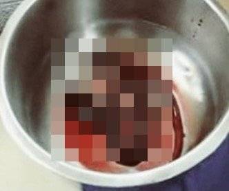 Journal of Clinical and Diagnostic Research 갈무리