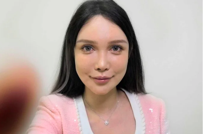 100회 이상의 성형수술을 받은 중국 인플루언서 애비 우. BBC