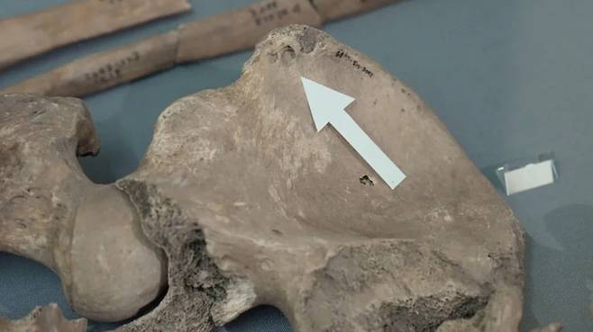 영국 요크 지역에서 발견된 검투사 유골에 남아 있는 이빨 자국. 사진=요크대학교