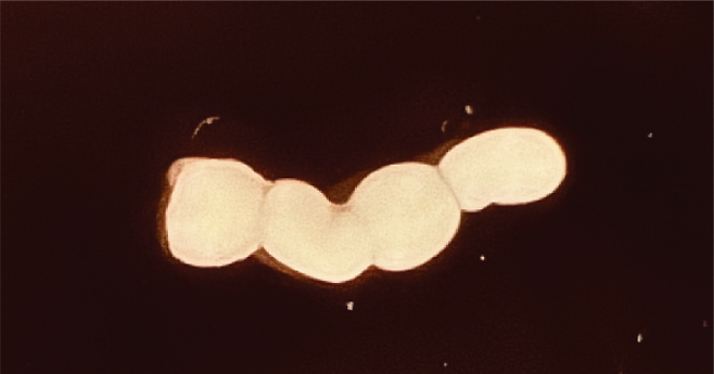 4개의 오가노이드를 이어붙인 어셈블로이드. 왼쪽부터&nbsp;감각 오가노이드, 척수 오가노이드, 시상 오가노이드. 김지일 박사후연구원 제공
