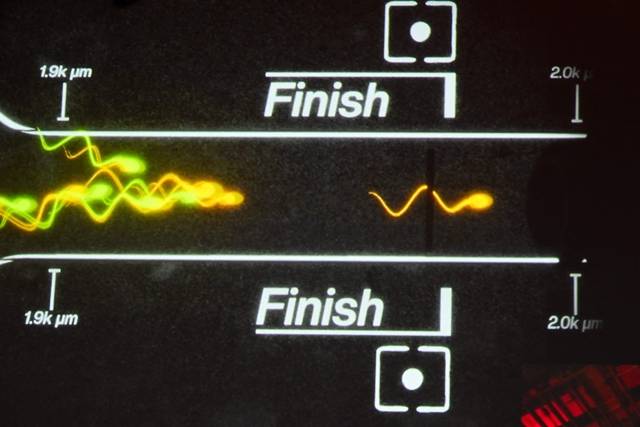 지난 25일 미국 캘리포니아주 로스앤젤레스에서 열린 정자 경주 대회가 실시간으로 시각화 돼 중계되고 있는 모습. AFP 연합뉴스