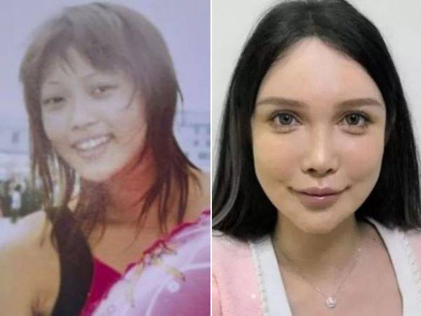 성형 수술에 약 7억 2000만 원을 소비한 중국 여성 애비 우의 성형 전(왼)과 후(오)의 모습/사진=BBC