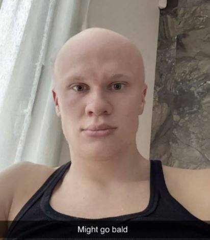 필터를 써 대머리가 된 엘링 홀란. 사진=데일리 스타