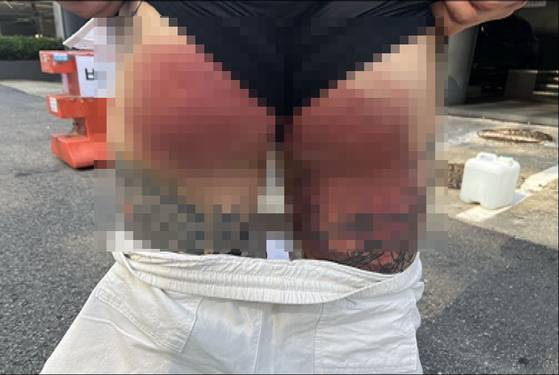 A gang member in Incheon who was beaten with a baseball bat by a fellow gang member [INCHEON DISTRICT PROSECUTORS OFFICE]