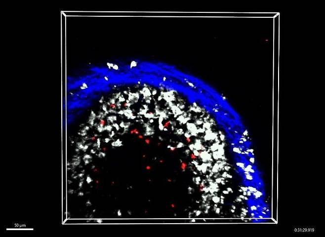 림프절(파란색) 내 대식세포(흰색)와 상호작용하는 기억 B 세포(빨간색) 생쥐 실험 결과 백신을 접종하면 기억 B 세포가 가장 가까운 림프절(dLN : draining lymph node) 외곽 층으로 이동해 그곳의 대식세포(macrophages)와 상호작용하는 것으로 나타났다.  [Dr Rama Dhenni 제공. 재판매 및 DB 금지]
