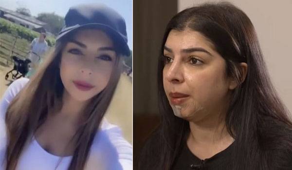 시술 받기 전(왼쪽)과 후(오른쪽)의 모습./사진=데일리메일