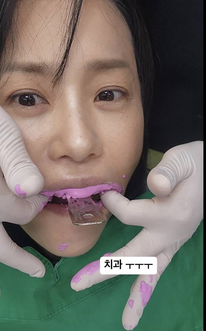 배우 고현정이 무방비의 순간을 공개했다. 사진=고현정 SNS