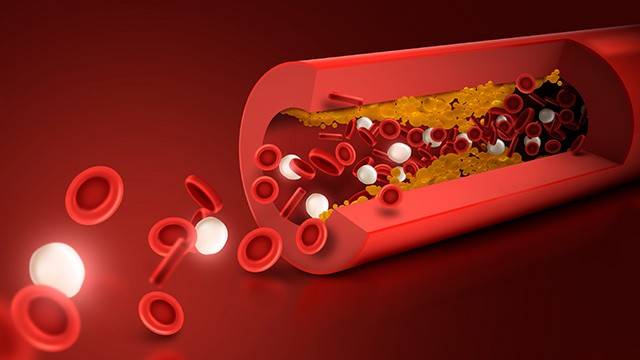 고지혈증은 몸 전체의 장기에 영향을 줄 수 있는 질환이다｜출처: 클립아트코리아
