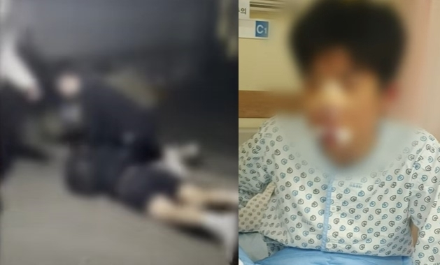 고등학교 3학년 남학생이 또래 남학생들에게 집단 폭행을 당하는 일이 벌어졌다. 피해 학생은 코뼈가 부러지는 등 전치 3주 진단을 받았다. [사진 출처 = 부산MBC 캡처]